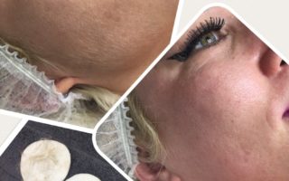 Dermaplaning facial, Chesterfield, The Nail and Beauty Lounge