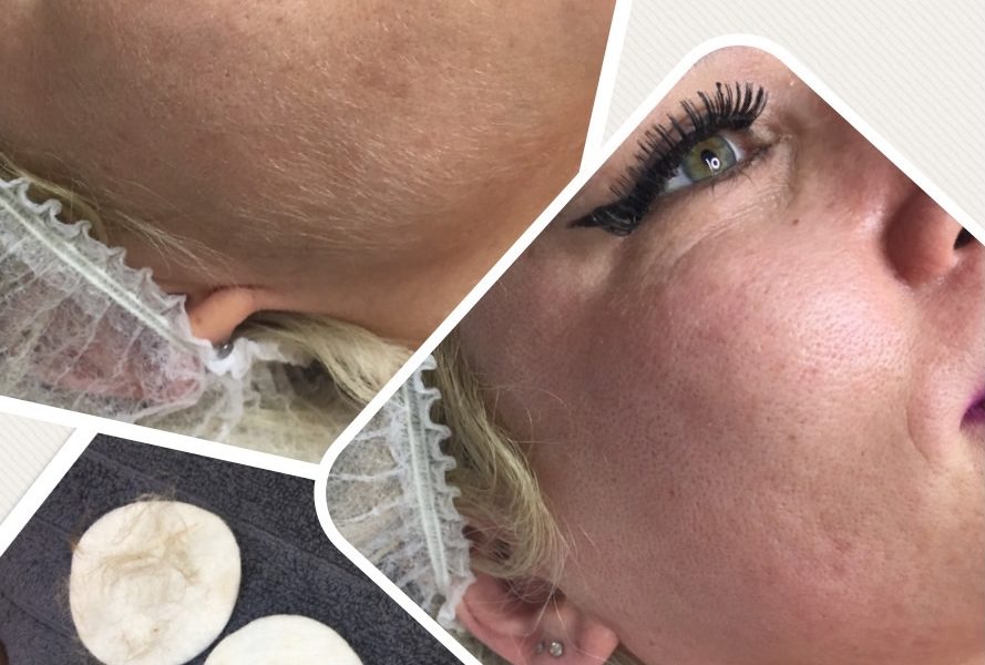 Dermaplaning facial, Chesterfield, The Nail and Beauty Lounge